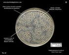 baird parker agar and staphylococcus aureus